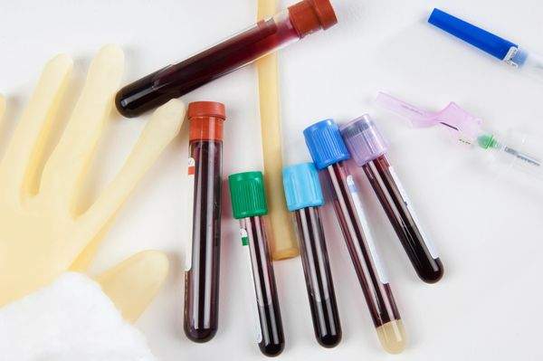 Phlebotomy Course-80 Hours